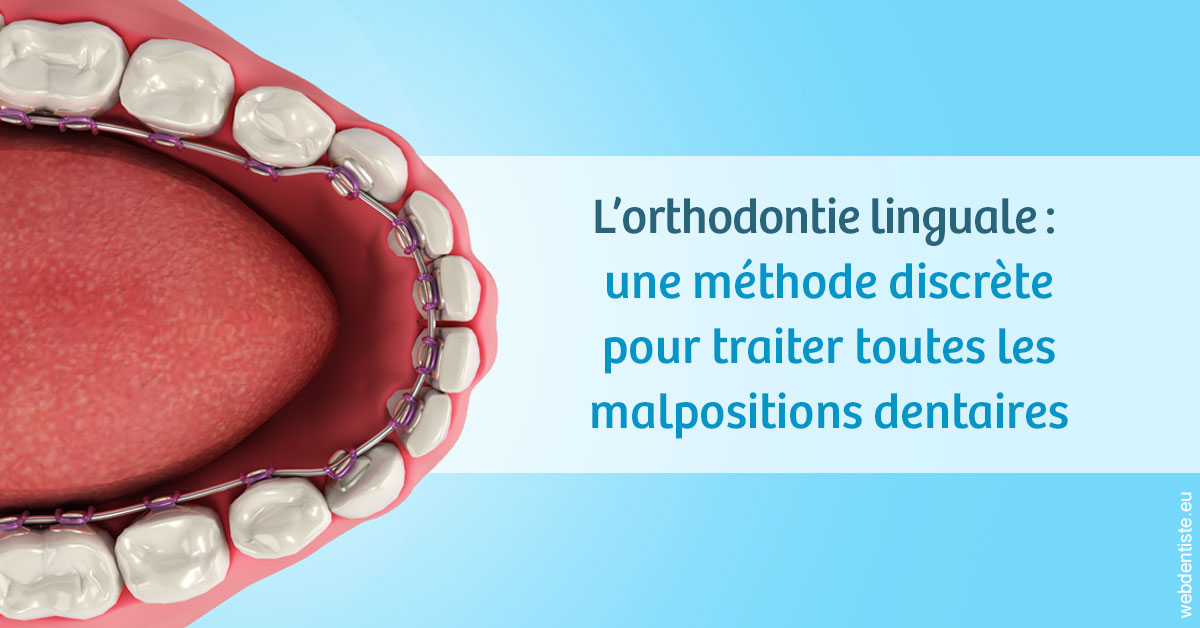 https://dr-bettinelli-dominique.chirurgiens-dentistes.fr/L'orthodontie linguale 1