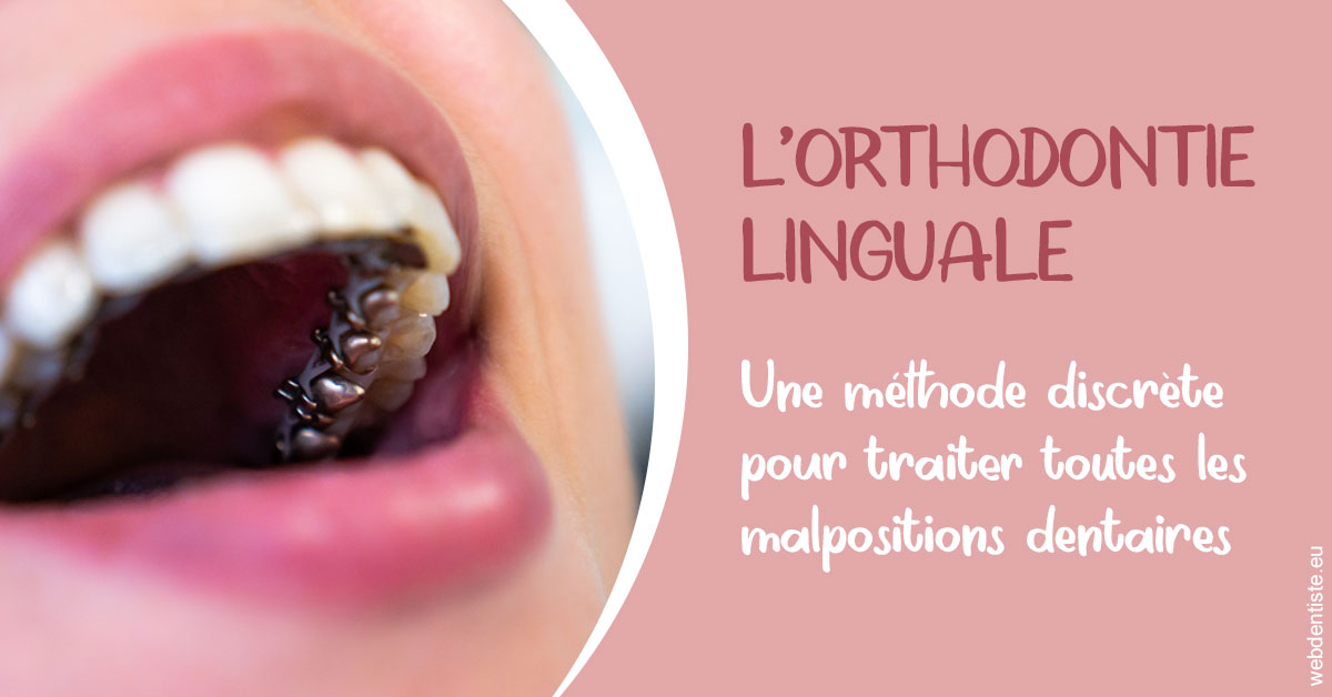 https://dr-bettinelli-dominique.chirurgiens-dentistes.fr/L'orthodontie linguale 2