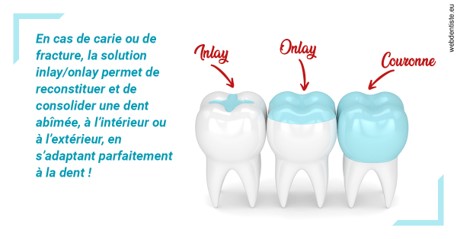 https://dr-bettinelli-dominique.chirurgiens-dentistes.fr/L'INLAY ou l'ONLAY