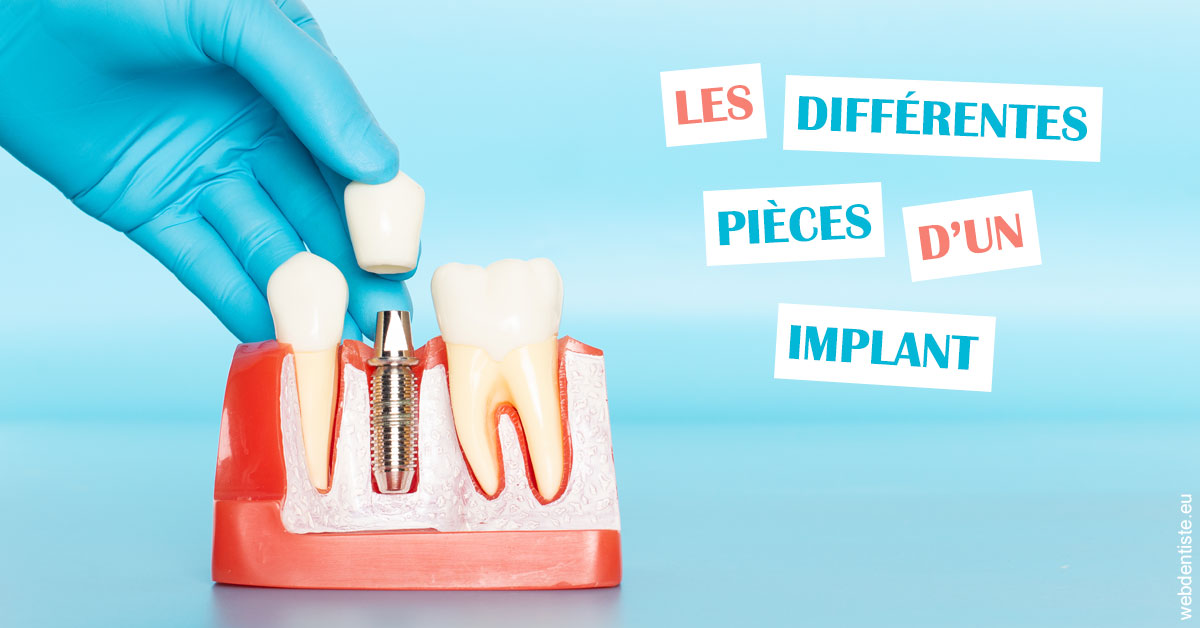 https://dr-bettinelli-dominique.chirurgiens-dentistes.fr/Les différentes pièces d’un implant 2