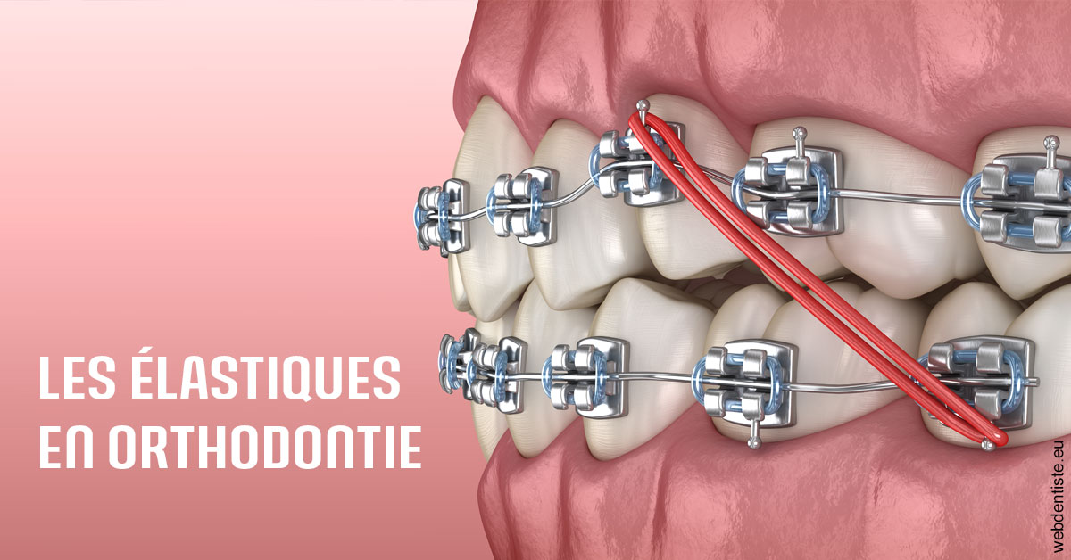 https://dr-bettinelli-dominique.chirurgiens-dentistes.fr/Elastiques orthodontie 2