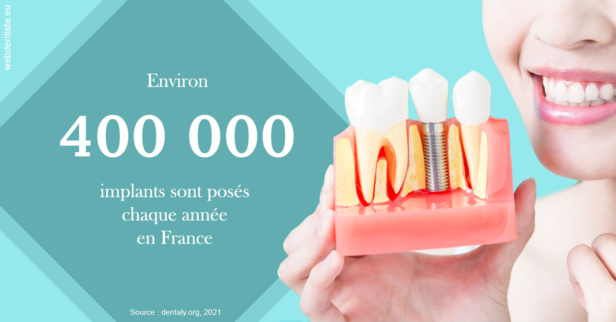 https://dr-bettinelli-dominique.chirurgiens-dentistes.fr/Pose d'implants en France 2